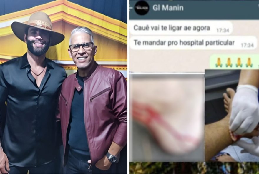 irmao-de-gusttavo-lima-relatou-mordida-de-macaco-com-sangramento-e-dormencia