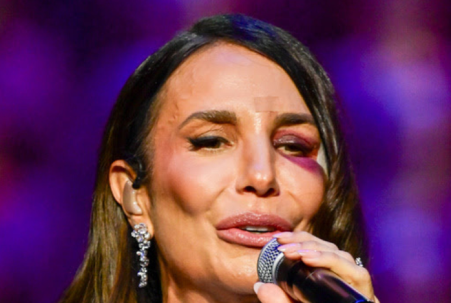 ivete-sangalo-enfrenta-cirurgia-de-emergencia-apos-desmaio3A-fe-e-determinacao-marcam-seu-processo-de-recuperacao ivete-sangalo-enfrenta-cirurgia-de-emergencia-apos-desmaio3A-fe-e-determinacao-marcam-seu-processo-de-recuperacao