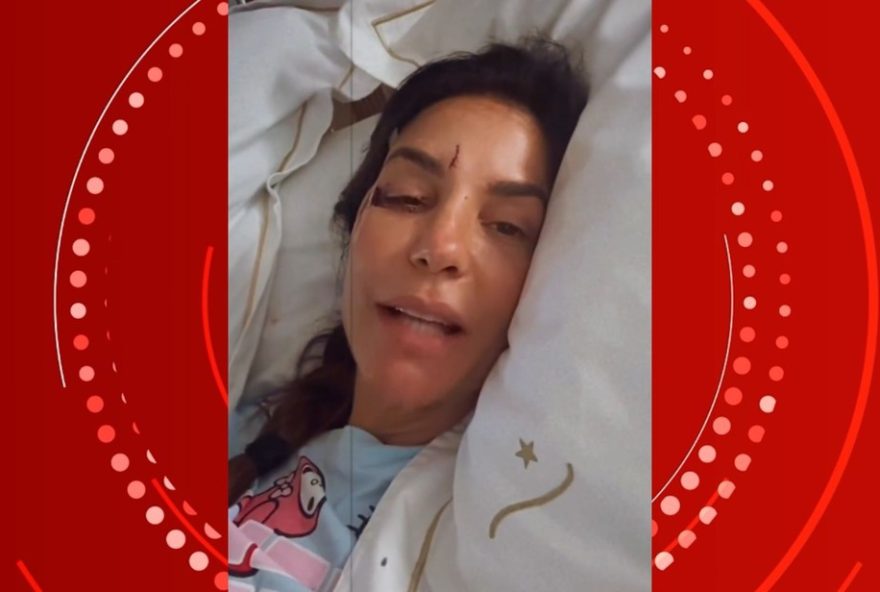 ivete-sangalo-surge-com-olho-roxo-apos-desmaiar-e-e-internada-em-hospital-de-salvador3A-famosos-enviam-mensagens-de-apoio ivete-sangalo-surge-com-olho-roxo-apos-desmaiar-e-e-internada-em-hospital-de-salvador3A-famosos-enviam-mensagens-de-apoio