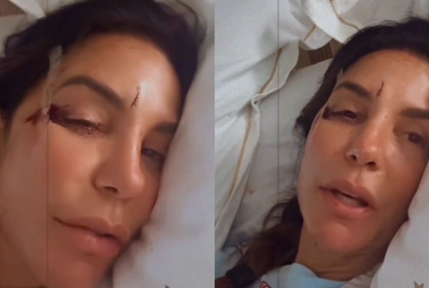 ivete-sangalo3A-superacao-apos-desmaio-e-internacao-por-virose-saiba-mais-sobre-a-cantora-e-sua-recuperacao ivete-sangalo3A-superacao-apos-desmaio-e-internacao-por-virose-saiba-mais-sobre-a-cantora-e-sua-recuperacao