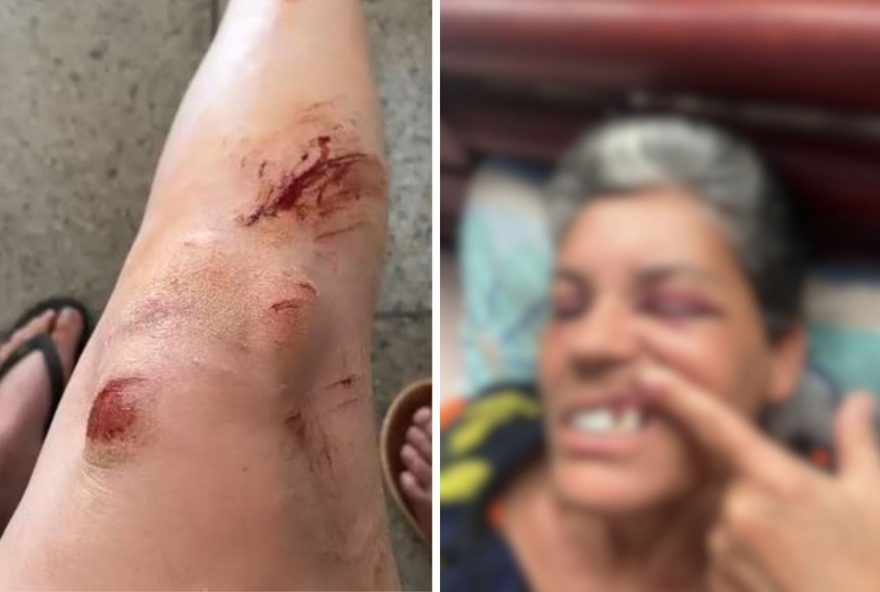 jovem-denuncia-agressoes-do-ex-companheiro-em-aparecida-de-goiania3A-mae-tem-dentes-quebrados.-policia-civil-investiga