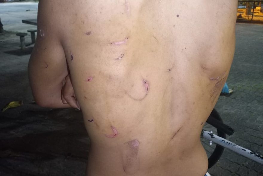 jovem-denuncia-tortura-fisica-e-psicologica-por-amiga-no-rio-de-janeiro3A-caso-em-investigacao-na-10a-dp-botafogo