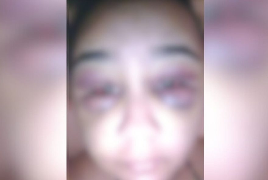 jovem-e-brutalmente-agredida-pelo-ex-apos-viagem-a-show-em-mg3A-suspeito-esta-foragido jovem-e-brutalmente-agredida-pelo-ex-apos-viagem-a-show-em-mg3A-suspeito-esta-foragido