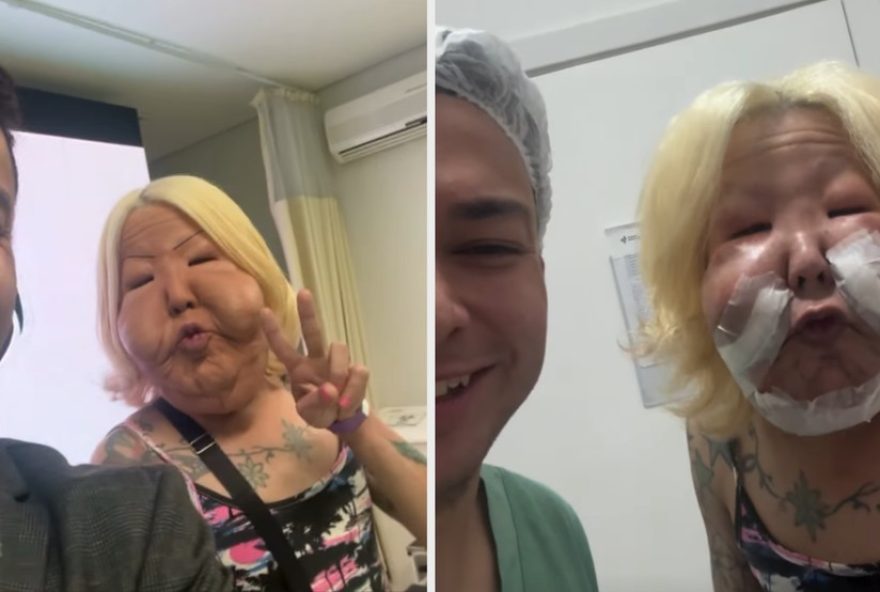 juju-do-pix-passa-por-cirurgia-para-retirar-oleo-mineral-do-rosto3A-antes-e-depois juju-do-pix-passa-por-cirurgia-para-retirar-oleo-mineral-do-rosto3A-antes-e-depois