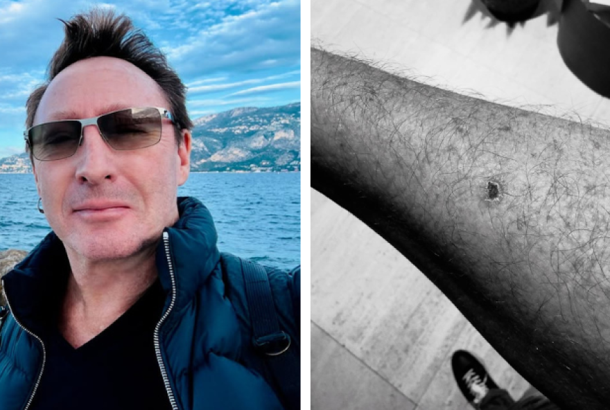 julian-lennon-cancer-cirurgia