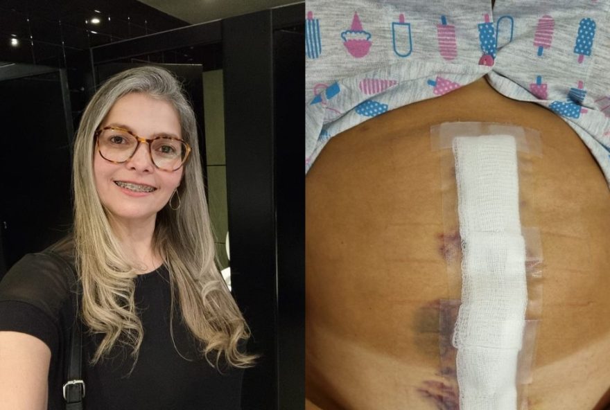 juliana-de-souza-dias-enfrenta-batalha-contra-tumor-raro-de-20cm-no-figado3A-mobilizacao-por-cirurgia-urgente