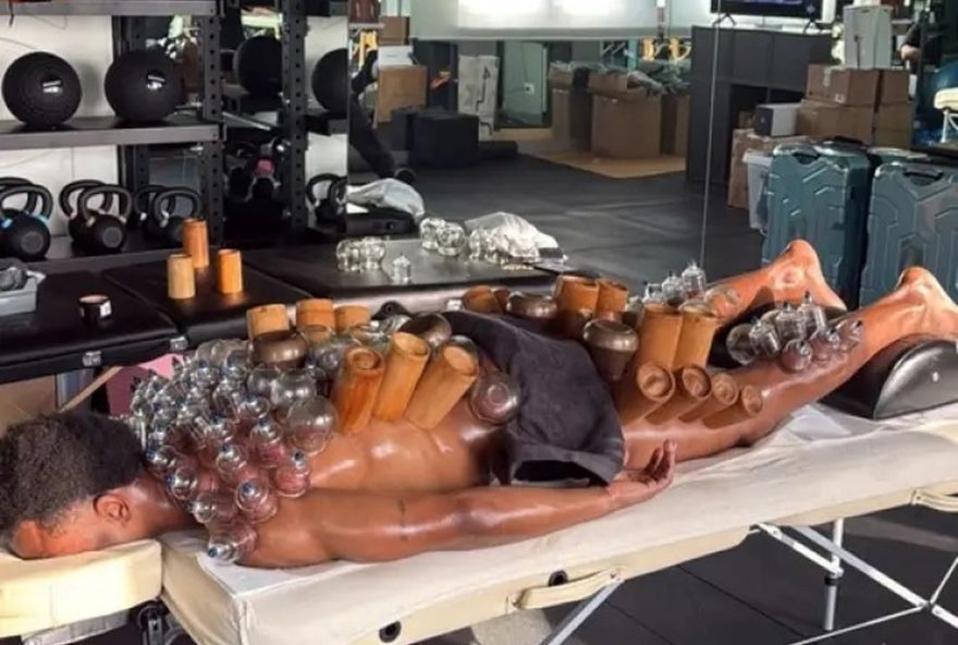 juventus3A-tratamento-com-ventosas-chama-atencao-em-recuperacao-fisica