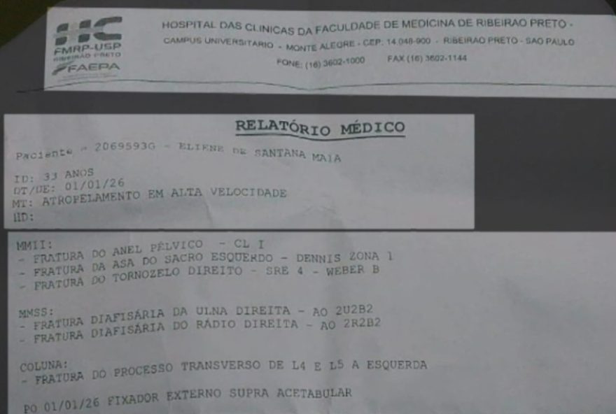 laudo-aponta-6-fraturas-graves-em-mulher-atropelada-com-filho-em-bonfim-paulista3B-crianca-morreu laudo-aponta-6-fraturas-graves-em-mulher-atropelada-com-filho-em-bonfim-paulista3B-crianca-morreu