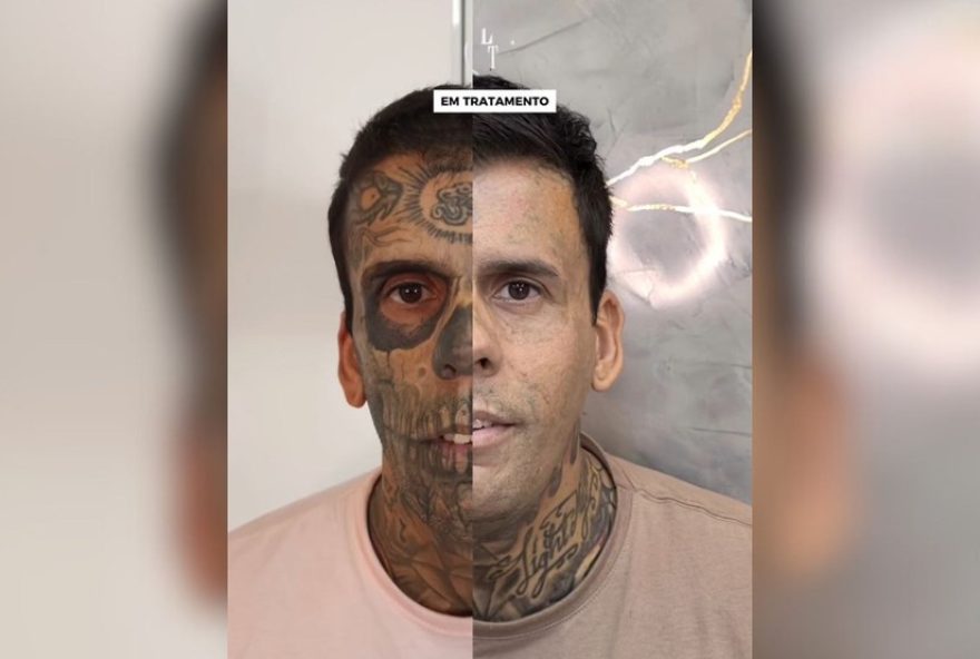 leandro-de-souza2C-o-mais-tatuado-do-brasil2C-realiza-sexta-sessao-de-remocao-de-tatuagens-antes-de-lancar-livro-sobre-sua-jornada-religiosa leandro-de-souza2C-o-mais-tatuado-do-brasil2C-realiza-sexta-sessao-de-remocao-de-tatuagens-antes-de-lancar-livro-sobre-sua-jornada-religiosa