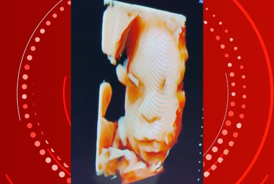 lore-improta-revela-reacao-de-liz-ao-ver-rosto-do-irmao-em-consulta lore-improta-revela-reacao-de-liz-ao-ver-rosto-do-irmao-em-consulta