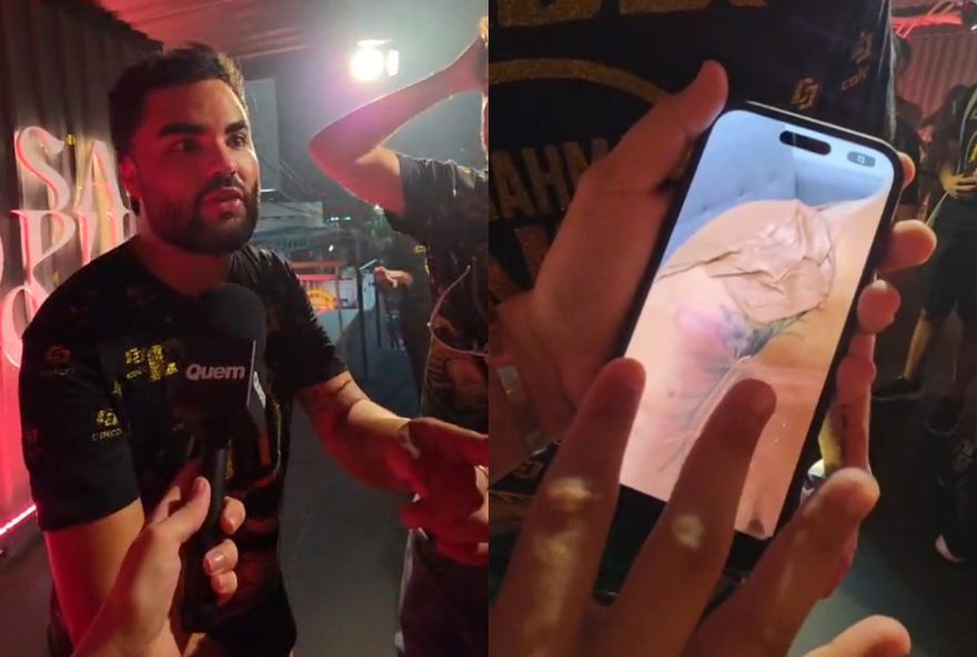 lucas-guedez-mostra-hematomas-de-virginia-apos-desfile-e-a-defende3A-estao-pegando-pesado-com-ela lucas-guedez-mostra-hematomas-de-virginia-apos-desfile-e-a-defende3A-estao-pegando-pesado-com-ela