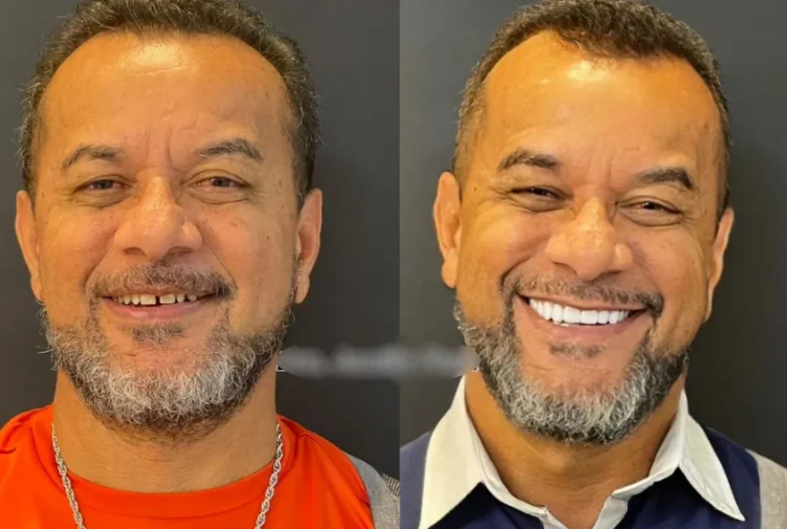 Luiz Carlos tinha o sonho de ter um belo sorriso, segundo marido. (Foto: Arquivo pessoal)