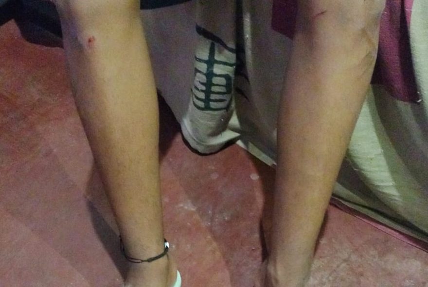 mae-acusa-pm-de-provocar-acidente-com-adolescente-em-bicicleta-eletrica mae-acusa-pm-de-provocar-acidente-com-adolescente-em-bicicleta-eletrica