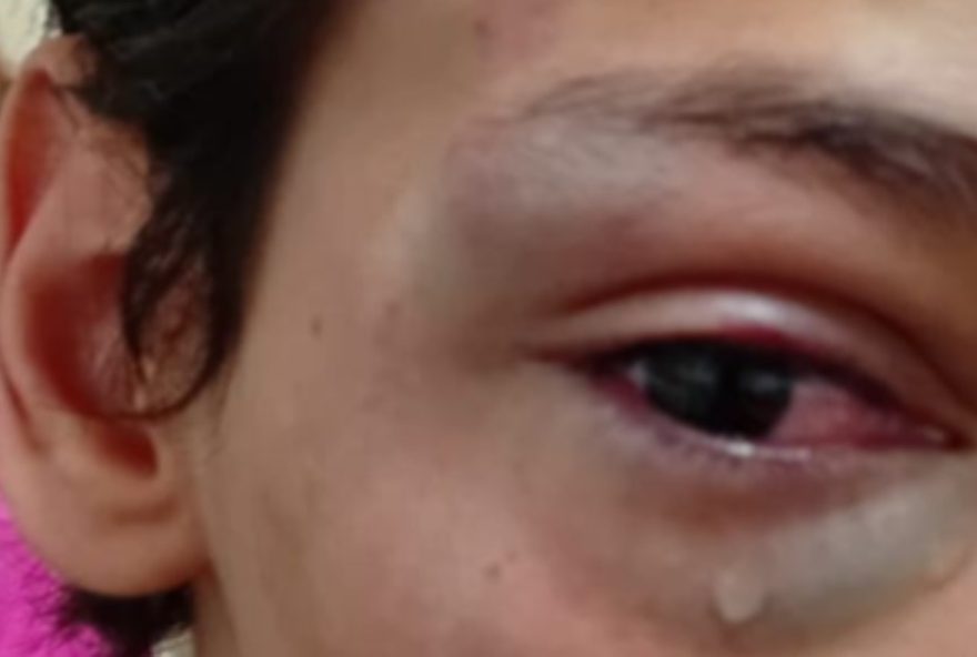 mae-denuncia-omissao-de-escola-apos-filho-autista-ser-agredido3A-cena-chocante-em-sao-joaquim-da-barra2C-sp