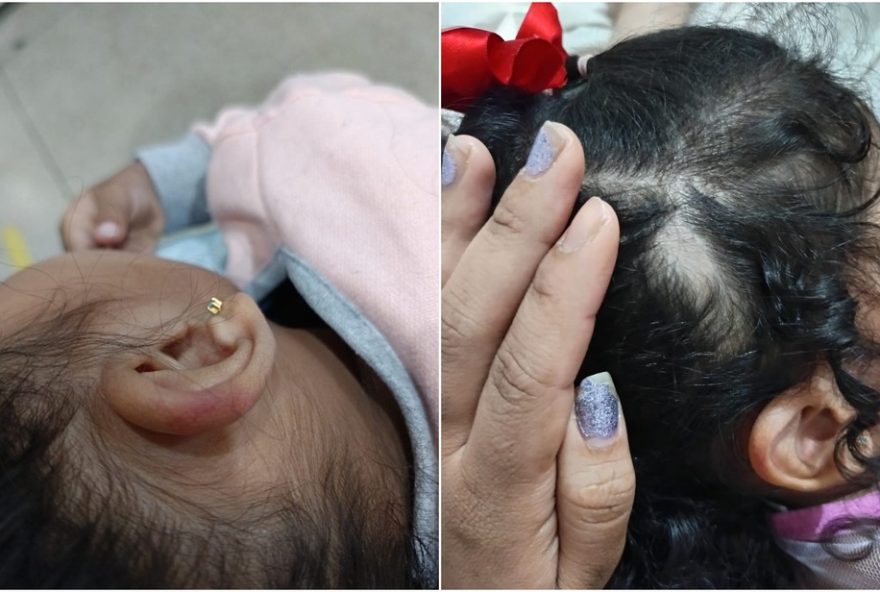 mae-denuncia3A-professora-arranca-cabelo-de-crianca-em-creche-de-goiania