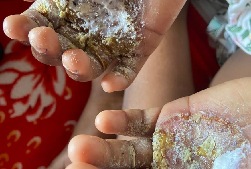 mae-e-presa-por-torturar-filha-com-ovos-quentes-em-niteroi3A-crime-choca-e-gera-comocao.-saiba-mais
