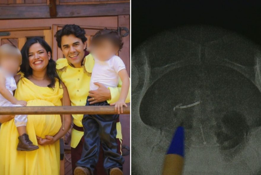 mae-engravida-com-diu-e-o-encontra-na-barriga-apos-3-anos3A-caso-raro-