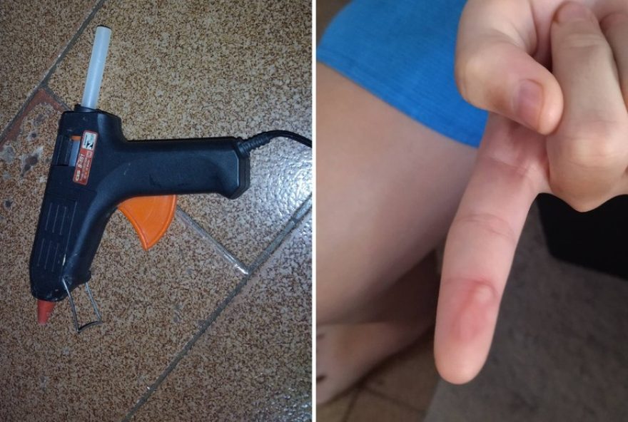 maes-denunciam-professora-suspeita-de-queimar-alunos-com-cola-quente-em-escola maes-denunciam-professora-suspeita-de-queimar-alunos-com-cola-quente-em-escola