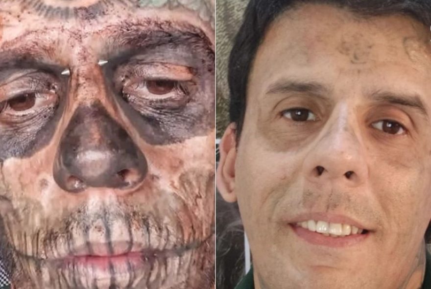 maior-tatuado-do-brasil-passa-por-remocao-e-transformacao-surpreendente maior-tatuado-do-brasil-passa-por-remocao-e-transformacao-surpreendente