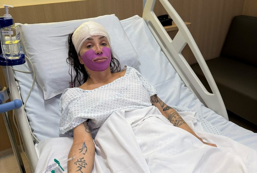 maya-massafera-detalha-nova-cirurgia-no-maxilar3B-relembre-todas-as-intervencoes-feitas-desde-o-inicio-da-transicao maya-massafera-detalha-nova-cirurgia-no-maxilar3B-relembre-todas-as-intervencoes-feitas-desde-o-inicio-da-transicao