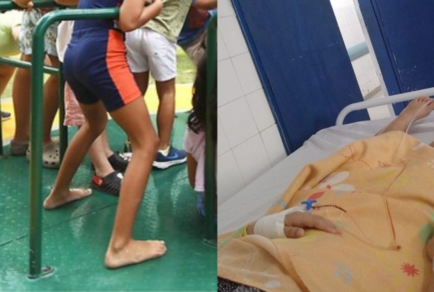 menina-tem-dedo-amputado-em-brinquedo3A-prefeitura-pede-cuidado-nas-pracas-da-infancia