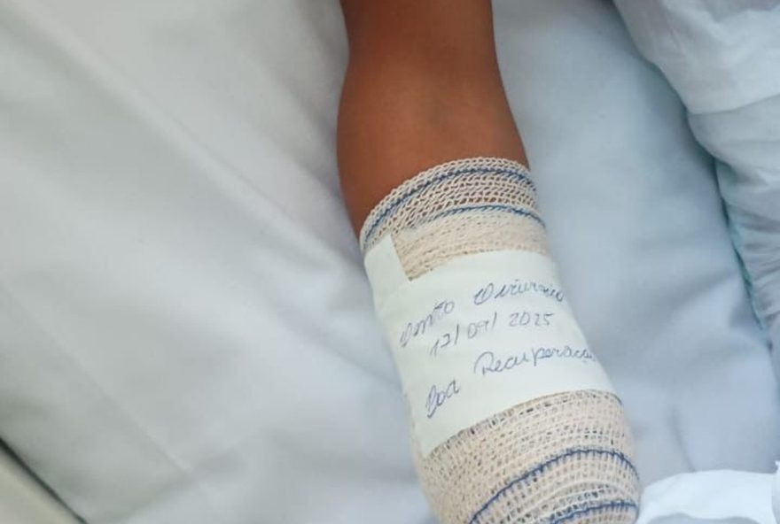 menino-de-8-anos-perde-mao-e-dedos-em-explosao3A-alerta-para-seguranca-em-costa-barros2C-rj