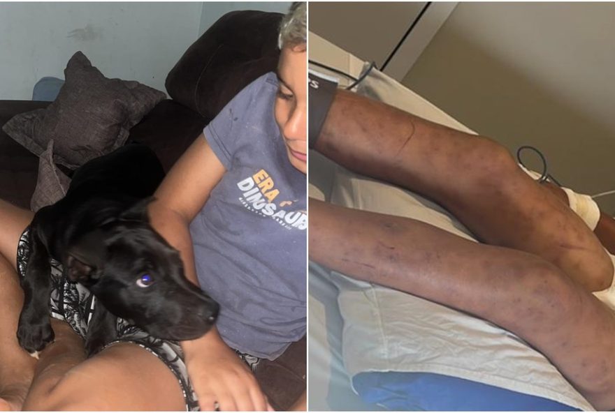 menino-picado-por-abelhas-ao-salvar-cachorro-na-mata3A-mae-relata-ataque-e-internacao-na-uti