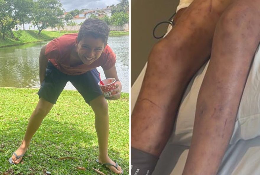 menino-picado-por-abelhas-de-cabeca-aos-pes3A-mae-relata-susto-e-resgate-emergencial menino-picado-por-abelhas-de-cabeca-aos-pes3A-mae-relata-susto-e-resgate-emergencial