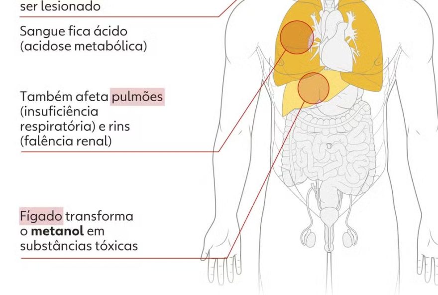 metanol3A-brasil-registra-47-casos-confirmados-de-intoxicacao2C-diz-ministerio-da-saude