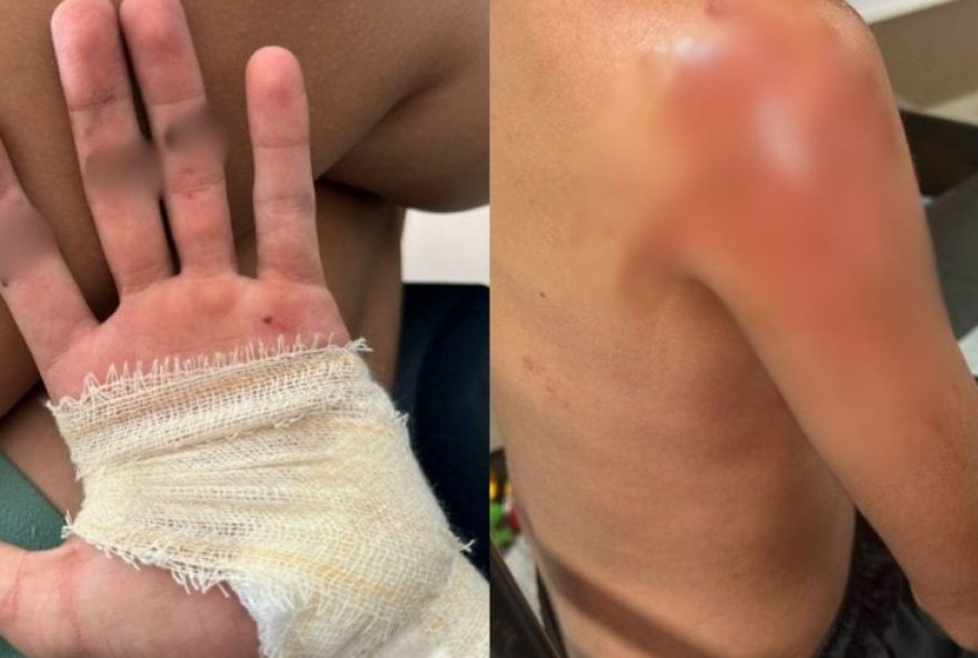 motociclista-e-arrastado-por-fios-soltos-em-joinville3A-acidente-choca-cidade-e-gera-repercussao motociclista-e-arrastado-por-fios-soltos-em-joinville3A-acidente-choca-cidade-e-gera-repercussao