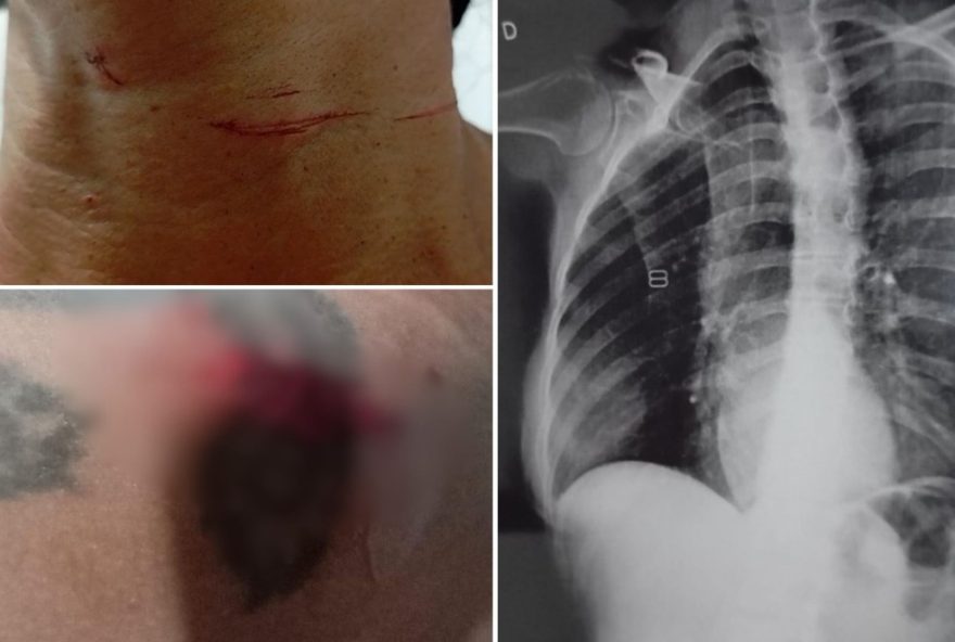 motociclista-se-joga-da-moto-apos-ser-atingida-por-linha-com-cerol-em-santos3A-teria-morrido-saiba-mais-sobre-o-caso-e-as-medidas-de-combate-ao-uso-irregular-de-pipas motociclista-se-joga-da-moto-apos-ser-atingida-por-linha-com-cerol-em-santos3A-teria-morrido-saiba-mais-sobre-o-caso-e-as-medidas-de-combate-ao-uso-irregular-de-pipas