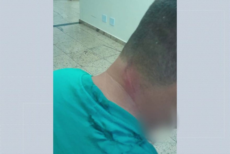 motociclista-tem-pescoco-cortado-por-fio-solto-em-ribeirao-preto3A-veja-detalhes-da-recuperacao