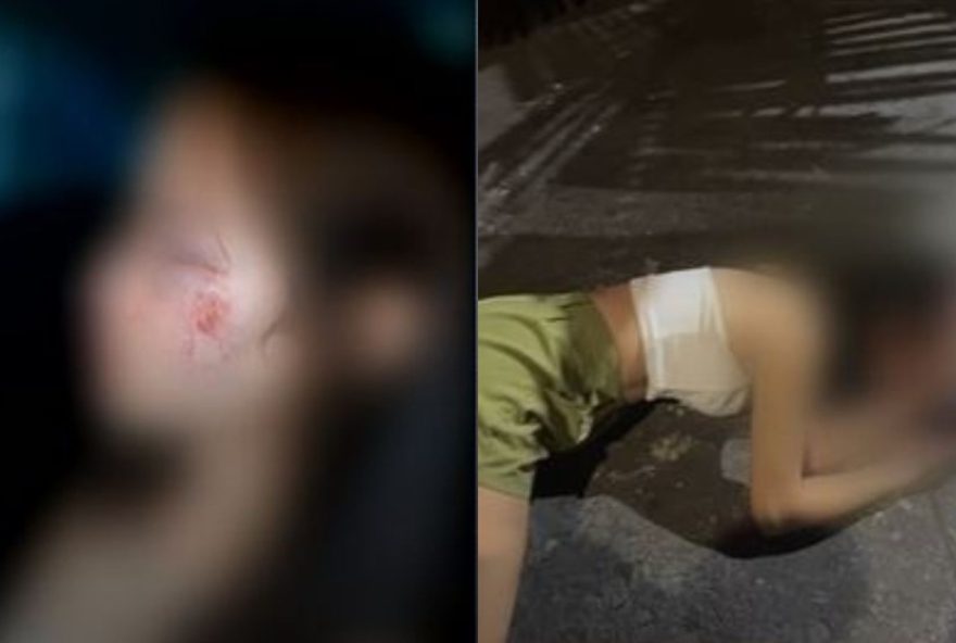 mulher-agredida-com-cloro-na-saida-de-boate-relata-violencia-em-goiania3A-me-bateram-la mulher-agredida-com-cloro-na-saida-de-boate-relata-violencia-em-goiania3A-me-bateram-la