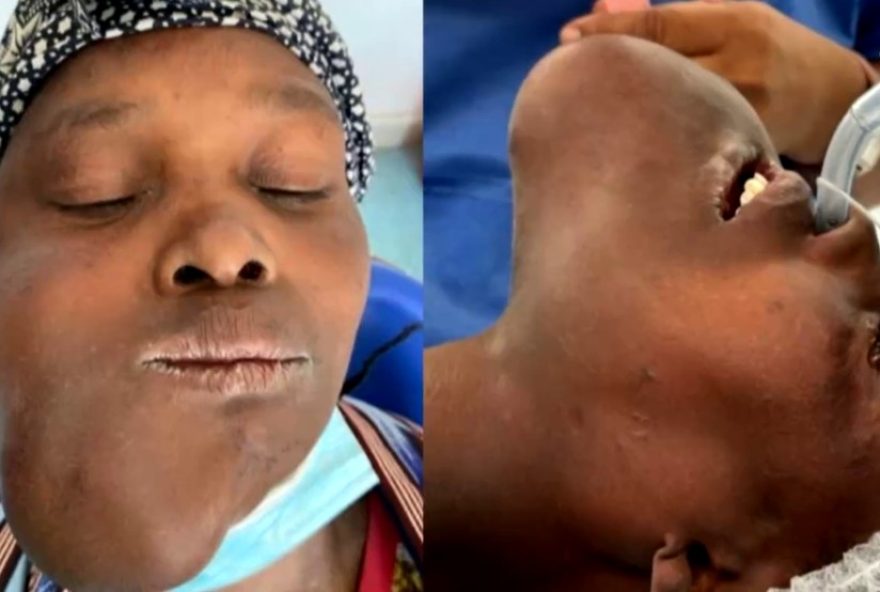 mulher-aguarda-1-ano-por-cirurgia-em-missao-humanitaria-medica-em-angola3A-a-emocionante-historia-de-pevendia-e-luzia mulher-aguarda-1-ano-por-cirurgia-em-missao-humanitaria-medica-em-angola3A-a-emocionante-historia-de-pevendia-e-luzia