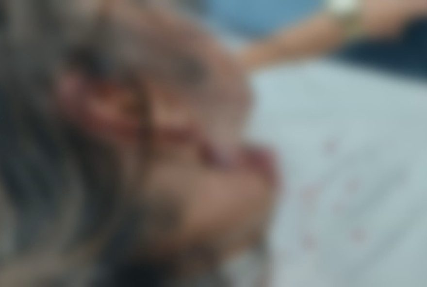 mulher-atacada-por-pitbull-ao-ajudar-cachorro-em-marechal-hermes3A-pitbull-preso-e-nao-vacinado