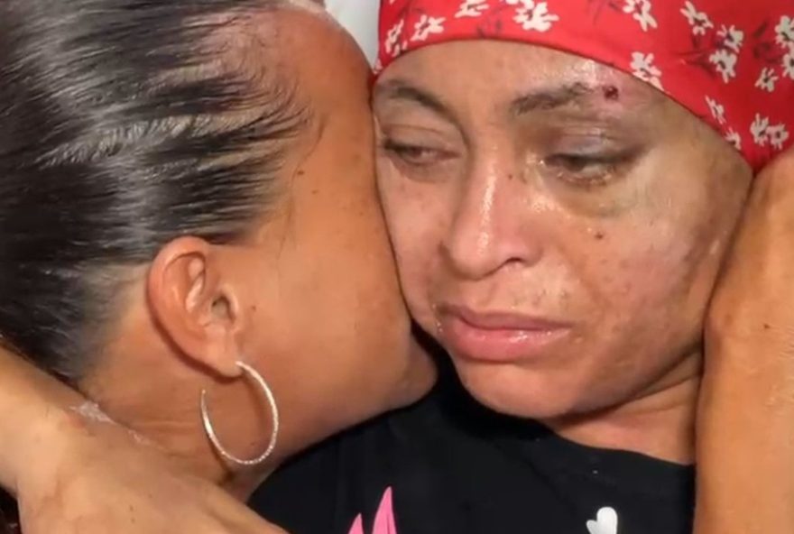 mulher-atropelada-e-dada-como-morta-em-bauru-agradece-equipe-medica-apos-alta3A-to-bem mulher-atropelada-e-dada-como-morta-em-bauru-agradece-equipe-medica-apos-alta3A-to-bem