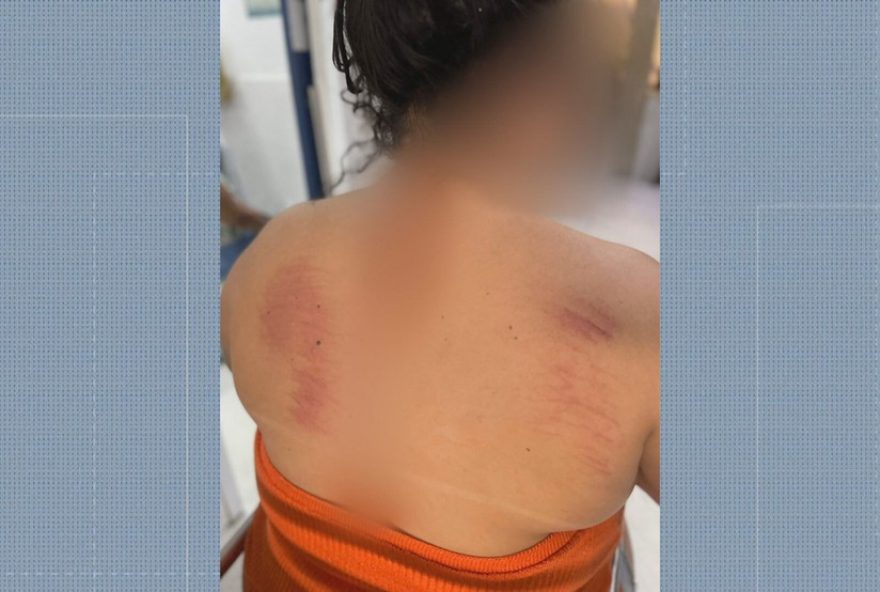 mulher-denuncia-agressao-e-roubo-pelo-ex-em-sao-goncalo