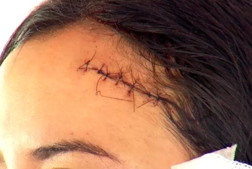 mulher-e-agredida-com-cadeirada-na-cabeca-ao-defender-amiga-em-bar