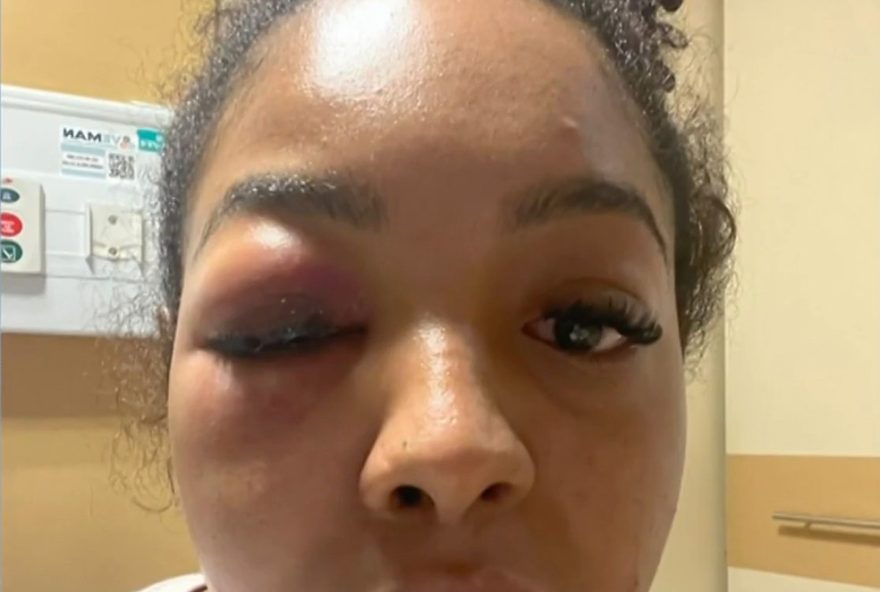 mulher-e-agredida-e-quase-estuprada-na-zl-de-sp3A-policia-procura-agressor