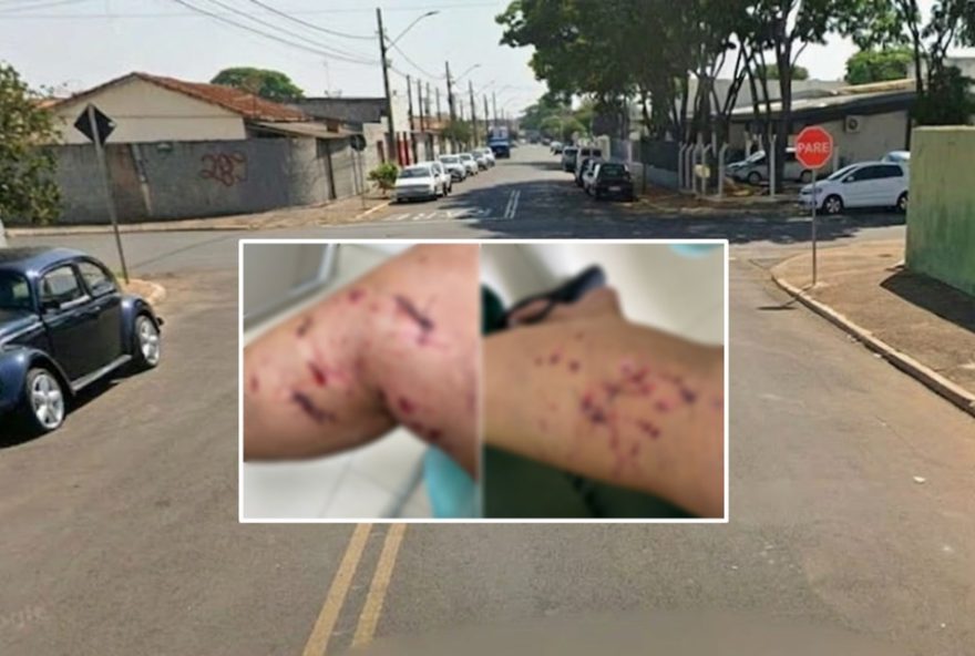 mulher-e-atacada-por-cao-pit-bull-em-conchal2C-sp3A-21-pontos-nas-pernas mulher-e-atacada-por-cao-pit-bull-em-conchal2C-sp3A-21-pontos-nas-pernas