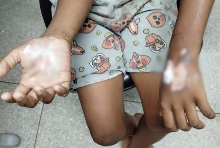 mulher-e-presa-por-torturar-filho-de-10-anos-em-jaboatao-dos-guararapes3A-irmaos-tambem-apreendidos