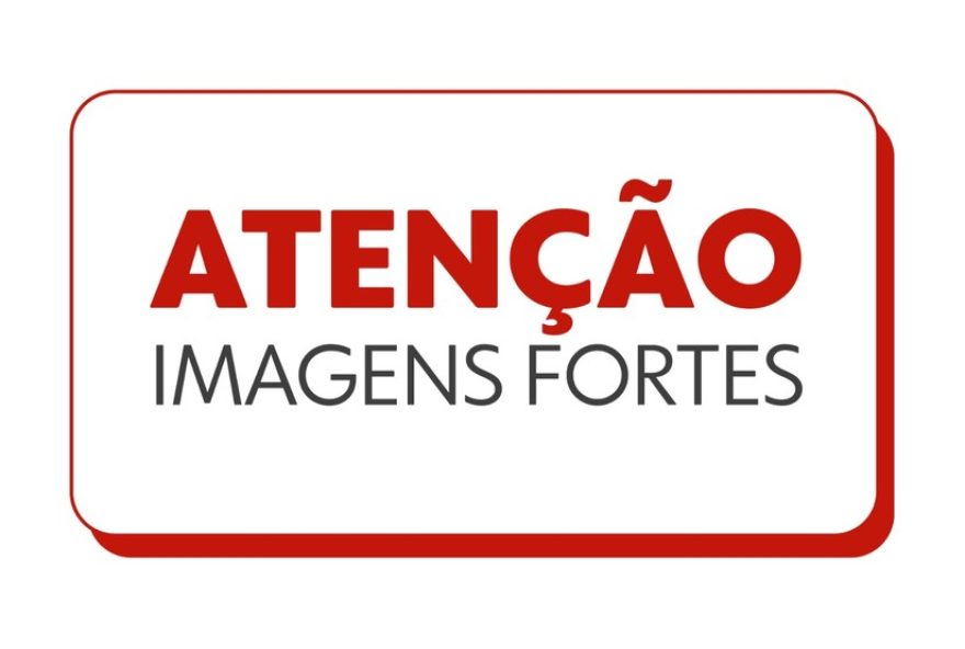 mulher-que-teve-labio-arrancado-por-cao-em-ro-passa-por-cirurgia-reconstrutiva-com-sucesso-em-sc3A-entenda-o-procedimento