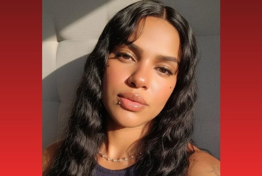 mulher-queimada-em-festa-de-carnaval-transferida-para-hospital-especializado mulher-queimada-em-festa-de-carnaval-transferida-para-hospital-especializado