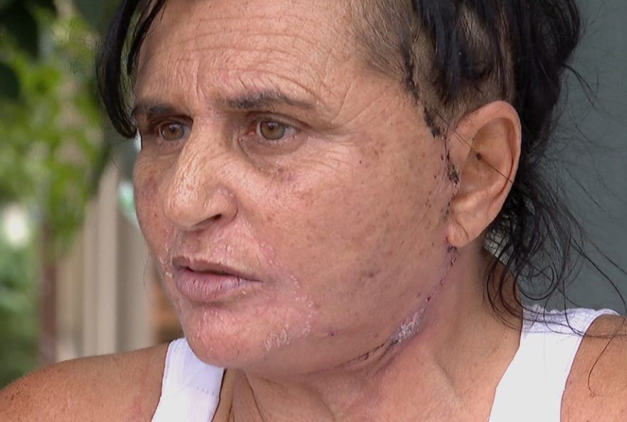 mulher-relata-complicacoes-apos-procedimento-estetico-com-dentista-em-ribeirao-preto3A-inocente mulher-relata-complicacoes-apos-procedimento-estetico-com-dentista-em-ribeirao-preto3A-inocente