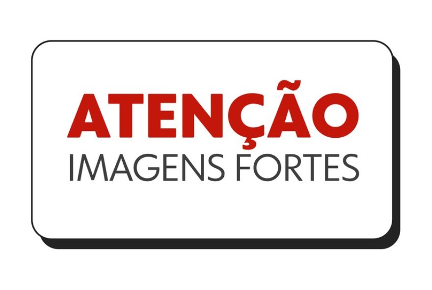mulher-satisfeita-com-cirurgia-reparadora-apos-mordida-de-cachorro-em-sc