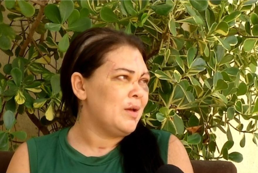 mulher-sobrevivente-de-feminicidio-enfrenta-traumas-e-luta-por-justica