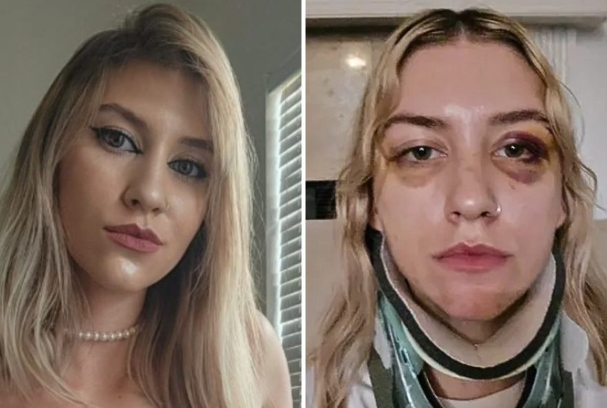 mulher-sul-africana-morta-por-namorado-nos-eua-relatou-agressoes-no-brasil3A-caso-chocante-em-curitiba0A
