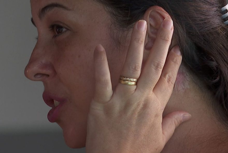 mulheres-denunciam-dentista-apos-complicacoes-esteticas3A-rosto-paralisado2C-necrose-e-sangramento mulheres-denunciam-dentista-apos-complicacoes-esteticas3A-rosto-paralisado2C-necrose-e-sangramento