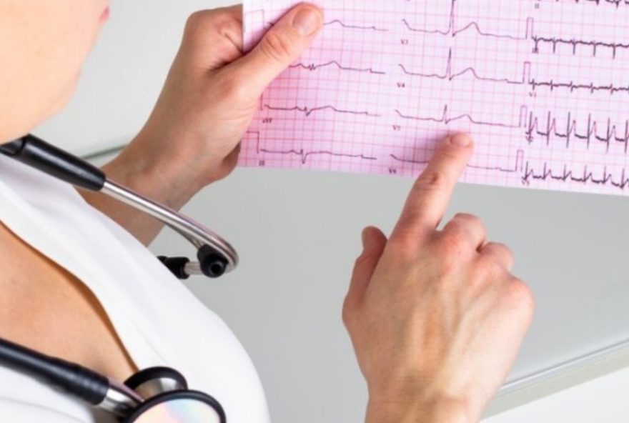 mutirao-de-exames-cardiologicos-em-pocos-de-caldas3A-mais-de-4-mil-atendimentos-em-novembro