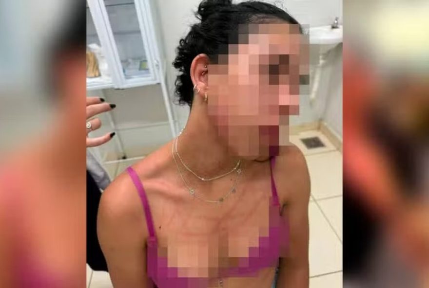 namorado-agride-jovem-por-ciumes-de-curtida-em-rede-social3A-suspeito-e-preso-e-solto-apos-pagar-fianca